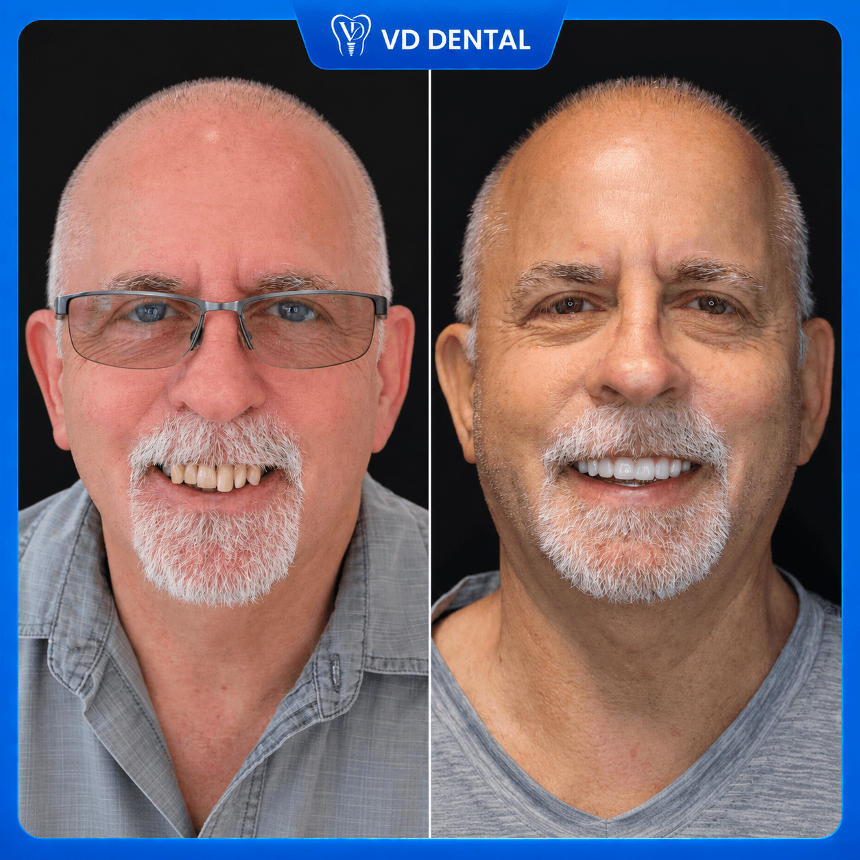 Patient Testimonial