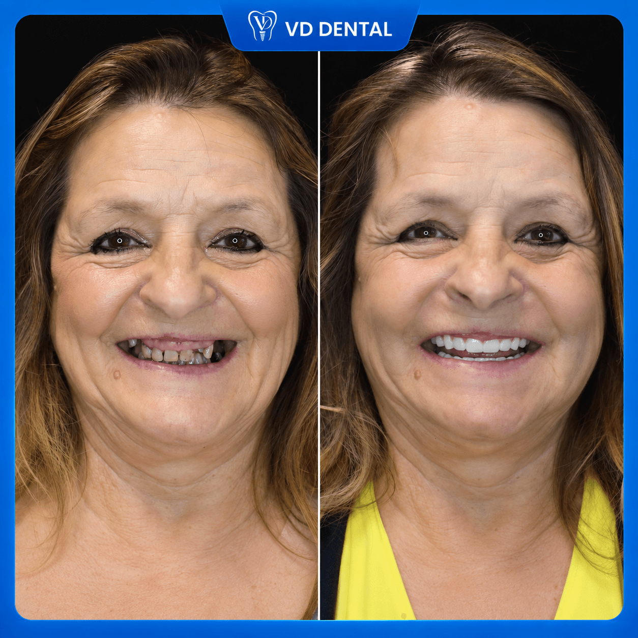 Patient Testimonial